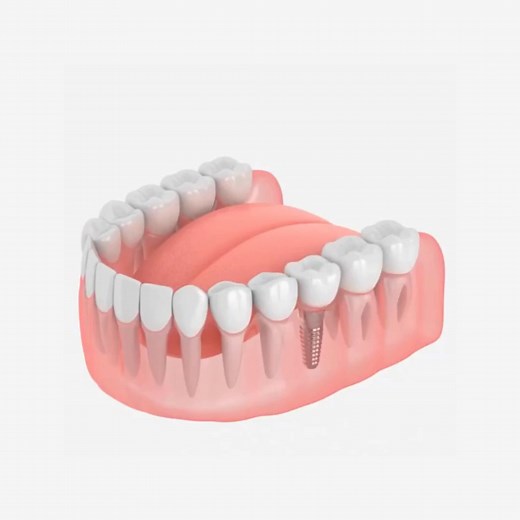 Polegate, are you ready to restore your smile and confidence? 🤩 Missing teeth? Dental implants are the next best thing to natural teeth! They restore your smile while letting you enjoy your favorite foods without worry. 🍎 Black Friday Offer: FREE Consultations This Month! 😍 Why Choose Us? ✔️ Experienced implant experts you can trust ✔️ Weekend & evening appointments for your convenience ✔️ Multiple implant options tailored to your needs 🚀 Ready to transform your smile? Secure your FREE consu