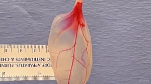 In the Future We’ll Grow Body Parts From Plants