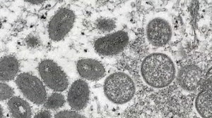 Monkeypox virus spreads around world