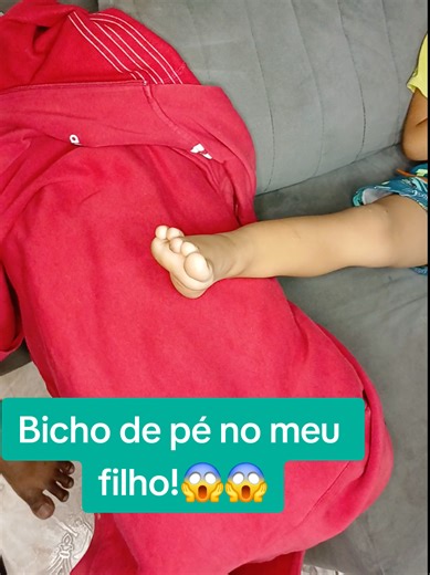 A experiência com bicho de pé no meu filho