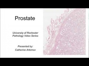 Histology of the Prostate