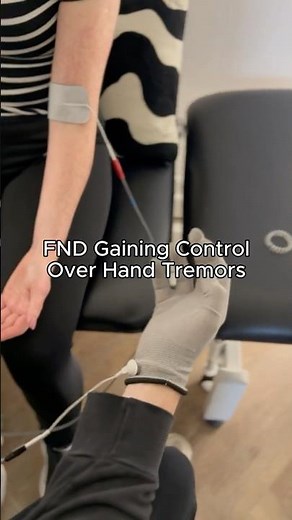 Controlling hand tremors (Functional Neurological Disorder) #functionalneurologicaldisorder #FND