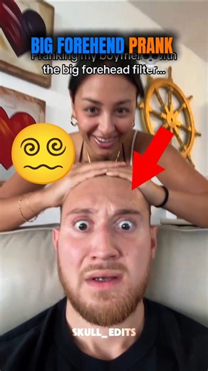 Biggest forehead in the entire world ‼️😱😵‍💫