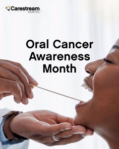🦷 April is Oral Cancer Awareness Month, and we’re shining a light on the importance of early detection and prevention! Carestream Dental is proud to support dental professionals who serve as the first line of defense through regular screenings and patient education. Together, we can make a difference! #OralCancerAwareness #EarlyDetectionSavesLives #HealthySmiles | Carestream Dental