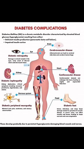 Daily NCLEX study tips✍🏽📚🧠 "Study smarter, not harder!💡Quick nursing notes to help you succeed, based on my own nursing school experience🧠✍🏽 1️⃣Follow me on TikTok @ Nurses QuickNotesTips LPN/RN 2️⃣FOLLOW & SHARE😊 3️⃣Let's study together📚 #nclextips #nclexprep #nurselife #studytips #highlightsシ゚ | Angel Nclex Prep Notes