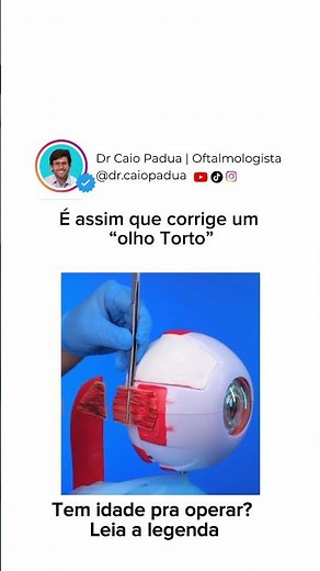 What is strabismus surgery like? Read the caption.