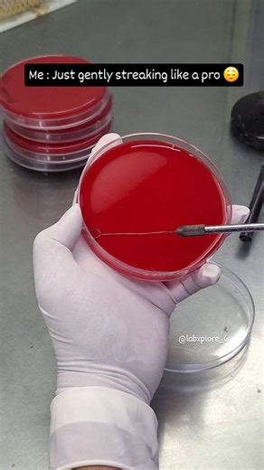 LabXplore on Instagram: "When the agar is way too soft to streak😑 #lablife #microbiologygirl #biotechnology #streaking #bloodagar #media #culture #instagood #trending #viral #lab #likes #share #subscribe #reels #sterile #follow #instagram #threads #content"