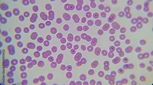 blood smear : Red blood cells from a dog suspected of babesiosis under a microscope