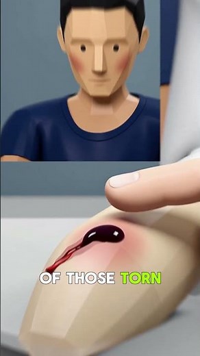 What's Actually Inside A Blood Blister 🤢 #facts #didyouknow