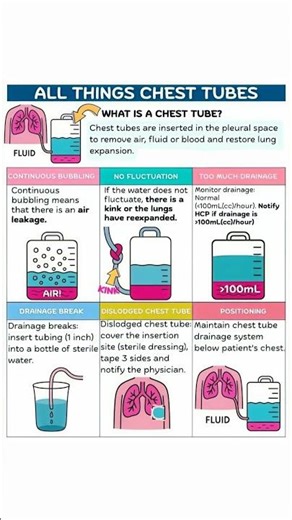 “Understanding Chest Tubes: A Quick Medical Guide”#ChestTube #Thoracostomy #Pneumothorax #Pleural#yt