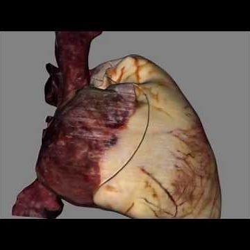 Virtual Heart 3D Dissection