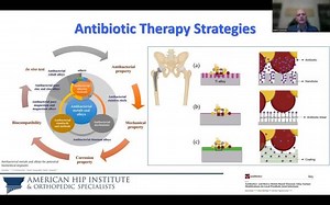 Total Hip Arthroplasty: The Latest and Greatest - From Minimally Invasive Surgery to Robotics