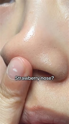 sebum magnet mask ✨GIVEAWAY✨👀 How to enter: 1) Participants need to follow both @milkydew_ and @cleardea_global 2) Tag a friend in the comments 3) I will select 10 winners on 9/04 4) I will personally DM the winners✨ to send the Green Tangerine Pore Toktok Mask :) #firstofthemonth #sebum #kbeauty #koreanskincare #glassskin #glowyskin #cloggedpores #sebumsoftener #skincare #skintok #sheetmask #sebum #blackhead #pores #glassskin #kbeauty #bumpyskin #oilyskin #facemask | MilkyDew