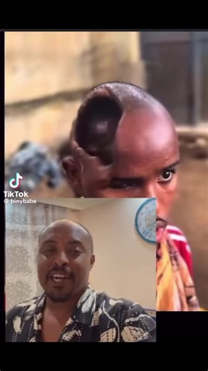 CAN OUR MEDICAL DRS AND BIOLOGISTS EXPLAIN HOW THIS BOY STILL A LIFE WHILE ALL THREE UNITES OF BRAIN LOOK DESTROYED??? According to science, the brain can be divided into three basic units: the forebrain, the midbrain, and the hindbrain. The hindbrain includes the upper part of the spinal cord, the brain stem, and a wrinkled ball of tissue called the cerebellum. The hindbrain controls the body's vital functions such as respiration and heart rate.It’s in a such a situation you can acknowledge the