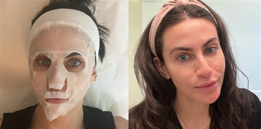I Got Salmon Sperm Injected Into My Face—Even Though It Hurt, I Would Absolutely Do It Again