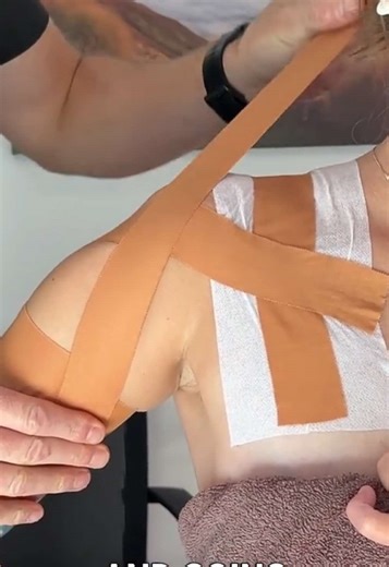 DISLOCATED SHOULDER? Learn how we tape it This taping technique helps prevent shoulder external rotation in a player, ideal to help prevent recurrent shoulder dislocation, as well support for subluxing shoulders (after a labral tear). We use a hypoallergenic Fixation Tape, rigid 38mm Sports tape and EAB Stretch Tape (for sport) Hypoallergenic Fixation Tape: https://shop.physiorehab.com/products/fixation-tape Sports Tape: https://shop.physiorehab.com/products/strapping-tape-38mm EAB Stretch Tape: