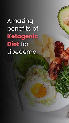 Benefits of Ketogenic Diet for Lipedema: Does this nutrition plan work for you?