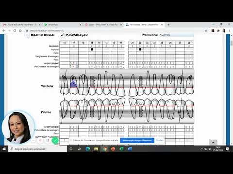 Preenchimento de periograma Esp em Periodontia