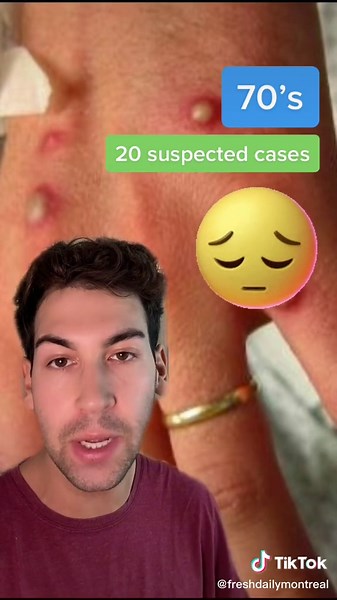 ugh 😣 #canada #montreal #mtl #longueuil #laval #sherbrooke #quebec #qc #fyp #foryoupage