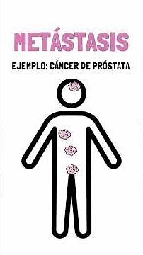 ¿Y si un tumor fuera como un ÁRBOL en un bosque?