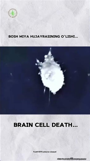 BOSH MIYA HUJAYRASINING O‘LISH JARAYONI…BRAIN CELL DEATH PROCESS…