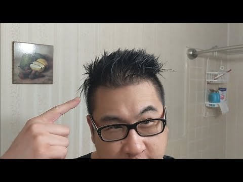 HEAD SHAVE IN SEARCH OF FLAKES! [PSORIASIS, PICKING, DANDRUFF]