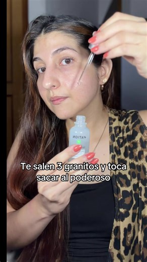 El arsenal para brotes inesperados 🔥 #acne #skincarecoreano #fation #centellaasiatica