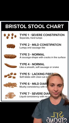 Understanding Bristol Stool Chart: Types of Poop and What They Mean