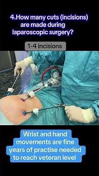 Laparoscopic Surgery Explained: Benefits, Procedure & Recovery