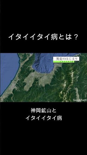 イタイイタイ病とは #イタイイタイ病 #公害 #4大公害病