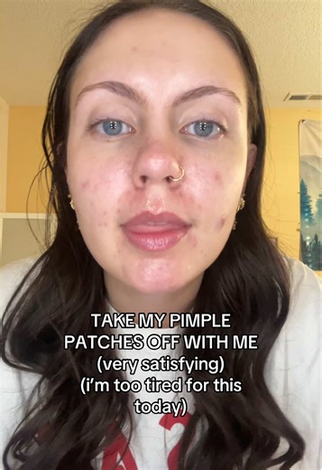 Pimple Patch Removal ASMR Experience