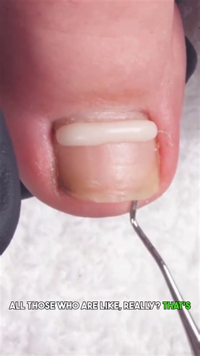 toe jam treasure #nailtech #pedicure #feet