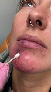 18 reactions | Learn how you can be the expert to fix broken Botox...