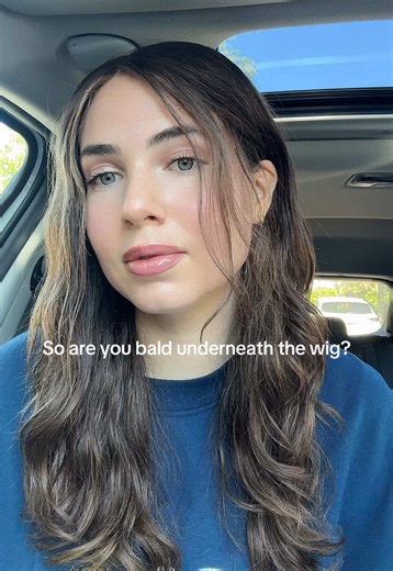 In all seriousness, while many Orthodox Jewish women cover their hair after marriage, shaving it is not a common practice. It is a niche custom observed by only a small minority within certain Hasidic groups.