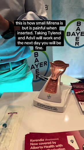 How #mirena is inserted? How small it is? Not as smooth as like this, but at least you have the idea how it is being released.