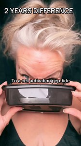 Two years ago, I was tipping the scales at around 215 pounds. I’ll be honest—my face was so puffy I could barely see out of my own eyes. That wasn’t just about looks… that was my body screaming at me. Fast forward to now: I’m fueling my body with cell-activating tablets, type II collagen, and a clean energy mood balancing drink. The difference? Night and day. Not only in how I look, but how I feel—lighter, stronger, clearer, and finally in control of my health. This is my two-year before & after