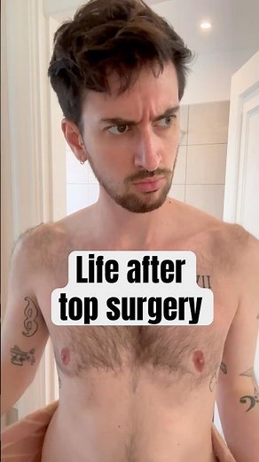Life after trans top surgery