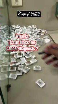 What is Tissue Block / Biopsy/ FNAC?#ytshorts #ytshortsvideo #biopsy #HPE #FNAC #tissueblock #shorts