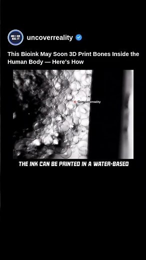 This Bioink May Soon 3D Print Bones Inside Human Body. Here's How #tech #shorts #medical #technology