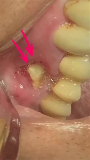 Stone Surgical Arts on TikTok