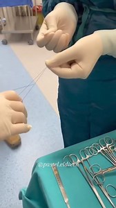 Test your knowledge and guess the procedure.. What stands out to you!! . . . . ..... Become a TORG Member: Follow the link below to learn more; https://forms.gle/XAW8ieZKWi1aZfDfA . . . ...... OUR GLOBAL COMMUNITY The Operating Room Global (TORG) https://www.operatingroomissues.org/ ✔️Instagram: www.instagram.com/operatingroomissues ✔️Facebook Page https://www.facebook.com/operatingroomissues ✔️LinkedIn Page https://www.linkedin.com/company/operatingroomissues/ ✔️ TORG YouTube. https://www.youtu