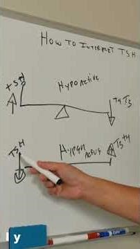 Hyperthyroidism simplified