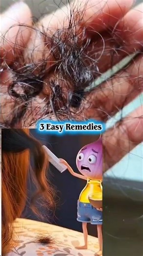 Dandruff & Hair Fall Control at Home | 3 Easy Remedies for Clean Scalp & Strong Hair#haircare#tips