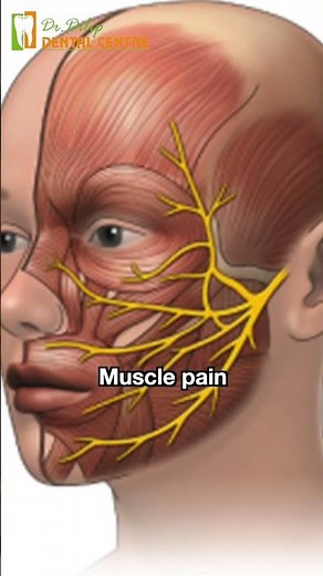 Understanding Facial pains | Dr Dhivya Dilipkumar
