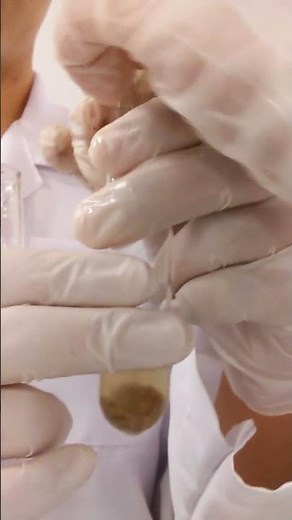 Experiment of H2O2 with catalyst (boiled liver)