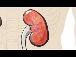 Robotic Kidney Surgery: What to Expect by Dr. Benjamin Lee