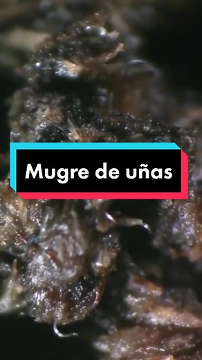 Mugre de uñas bajo el microscopio: Descubre la verdad
