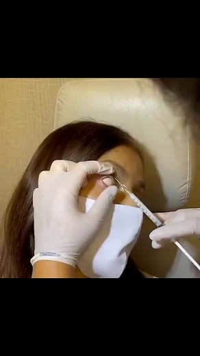 NORTHERNLIGHT EYE CENTER on Instagram: "PERIOCULAR STERIOD INJECTION Periocular administration means drug injection to a region surrounding the eye, for example sub-conjunctival, sub-Tenon's, peribulbar, retrobulbar or posterior juxtascleral injections. It is well-established route of treatment for severe uveitis, cystoid macular edema (CME) and vitritis #uveitis #inflammatory #inflamation #diseases #eye growth #diseases #trending #glaucoma #cataract #optometrist #opthalmologist #ophthalmology #