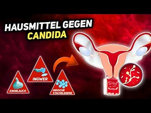 9 Natural Home Remedies for Candida