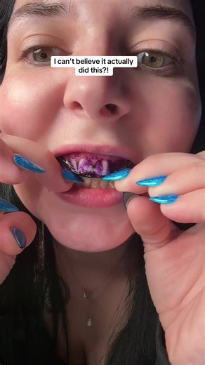 Effective Teeth Whitening Methods That Actually Work